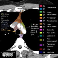 Thoracic Lymph Node Stations Annotated Ct